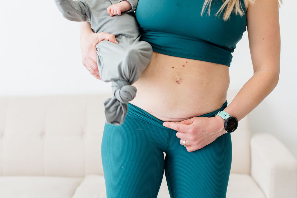 Mom showing a C-section scar and holding a baby. She was working out to heal her pelvic floor after a C-section.