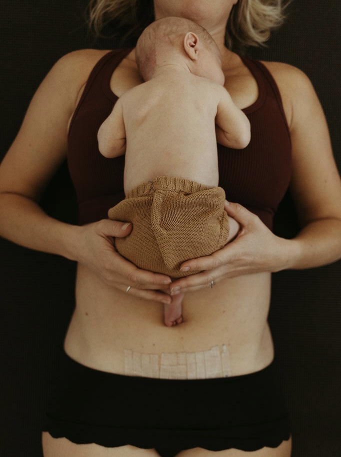 Learn how to heal your pelvic floor after a C-section.