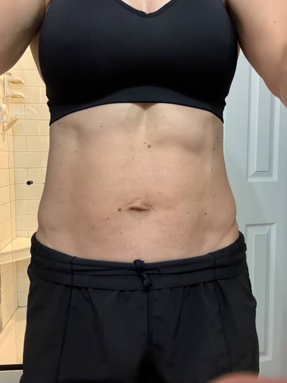 Example of rib flare.